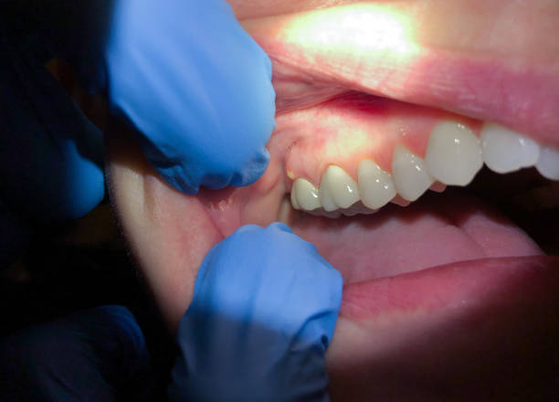 Best Emergency Care for Gum Disease in Lyman, MS