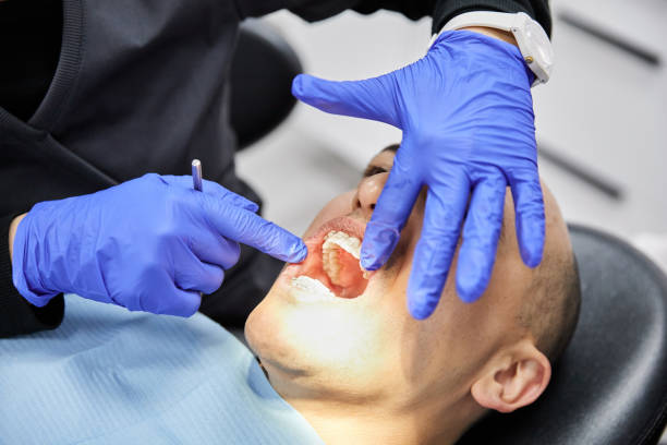 Best Emergency Wisdom Tooth Extraction in Lyman, MS