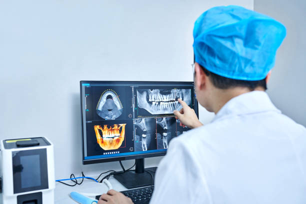 Best Knocked-Out Tooth (Avulsed Tooth) Treatment in Lyman, MS